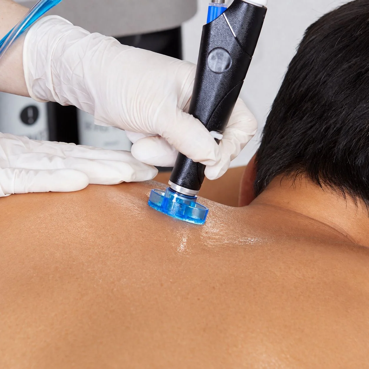 Hydrofacial Körperbehandlung Schulter und Rücken
