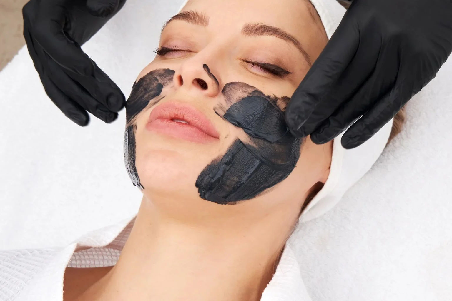 Carbon Peeling Hollywood Peeling in Langen